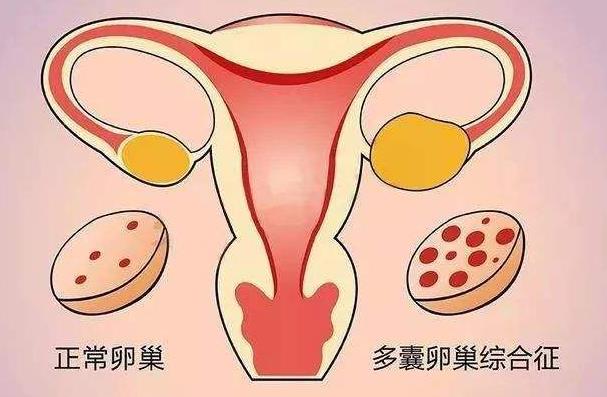 胚胎移植后注意这些方面，才能提高胚胎着床的成功率